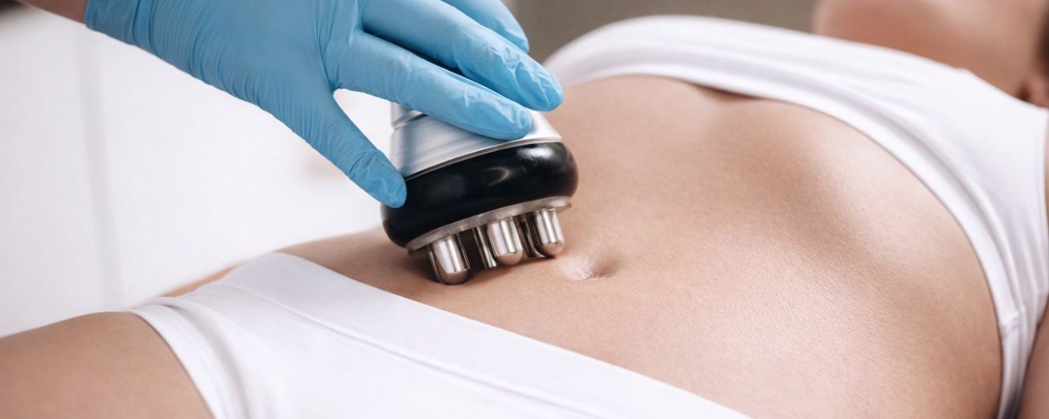 radiofrekvencna-liposukcia